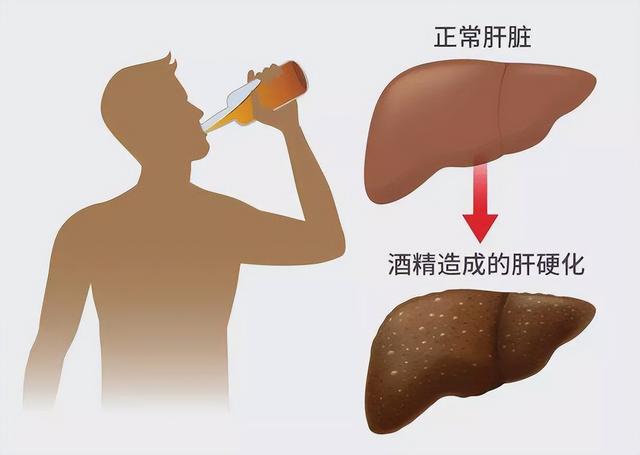 经常喝酒的人吃什么养胃护肝(常喝酒的人吃什么药护肝)